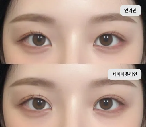 쌍꺼풀 라인 시뮬레이션